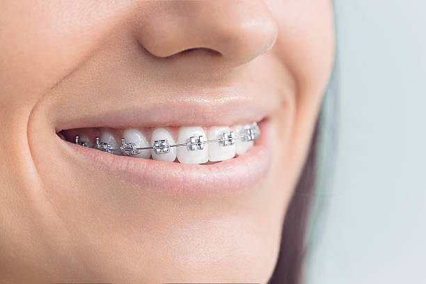 Best Dental Fillings (Composite and Amalgam)  in Helena Valley Northeast, MT